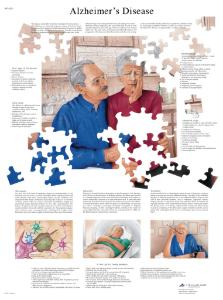 3B Scientific® Alzheimer Disease Chart