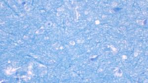 Cerebrum, section, luxol fast blue and cresyl violet stained slides - 400×3