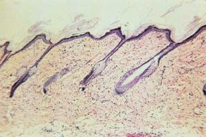 Skin of Hairy Mammal Slide
