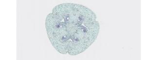 Lilium Ovary, Megaspore Mother Cell Slide