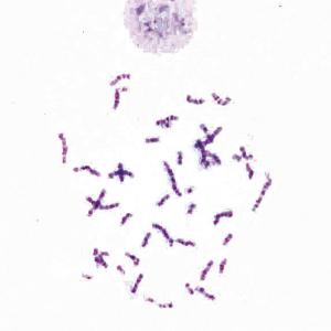 Chromosomes, Human Trisomy 21, 47 XX +21 Slide