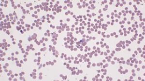 Plasmodium falciparum gametocytes