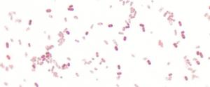 Disease-Causing Bacteria Slide Set