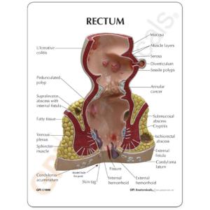 GPI Anatomicals® Rectum Model