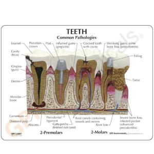 GPI Anatomicals® Basic Teeth Model