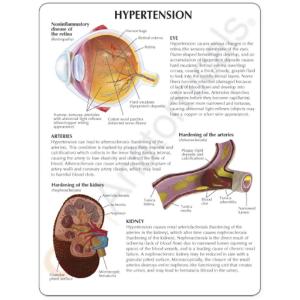 GPI Anatomicals® Hypertension Model Set