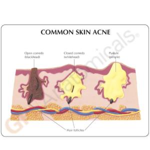 GPI Anatomicals® Skin Health Models