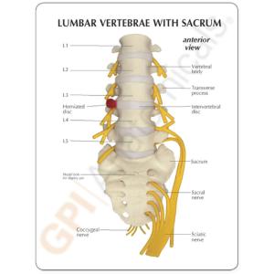 GPI Anatomicals® Flexible Lumbar Vertebrae Model
