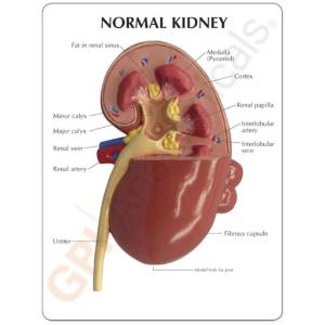 GPI Anatomicals® Kidney Pathology Model