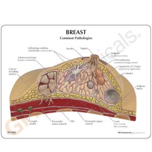 GPI Anatomicals® Basic Breast Cross Section Model