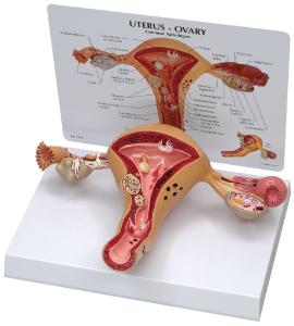 GPI Anatomicals® Basic Uterus Model