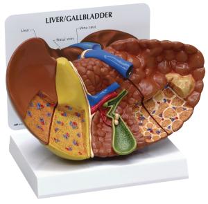 GPI Anatomicals® Liver Pathology Model