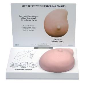 GPI Anatomicals® Left Breast With Irregular Masses Model