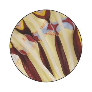 GPI Anatomicals® Rhumatoid Arthritis Hand
