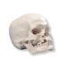 3B Scientific® Skull With Cleft Jaw And Palate