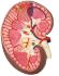 3B Scientific® Kidney Section Models
