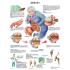 3B Scientific® Arthritis Chart