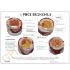 GPI Anatomicals® Basic Bronchus Model