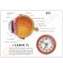 GPI Anatomicals® Cataract Eye Model