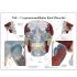 GPI Anatomicals® TMJ/Temporomandibular Model